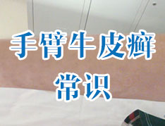 治疗银屑病需要注意什么